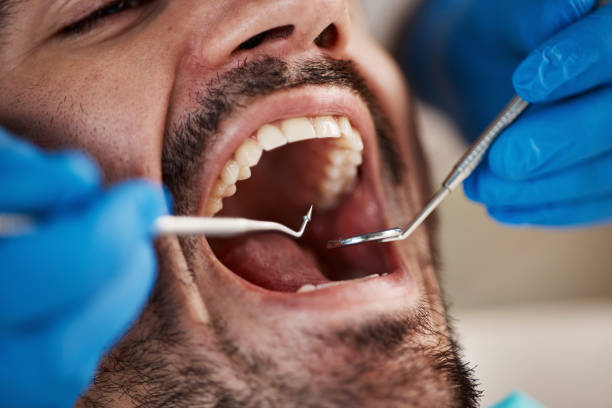Best Pediatric Emergency Dentist in Ozona, TX